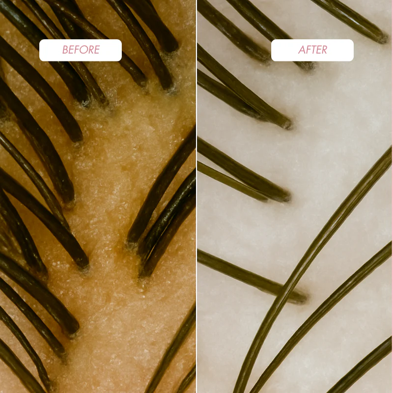 ProHair Scalp Reset – Trychologiczny duet oczyszczający (Szampon + Peeling) - Image 14